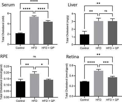 Chinese medicine, Qijudihuang pill, mediates cholesterol metabolism and regulates gut microbiota in high-fat diet-fed mice, implications for age-related macular degeneration